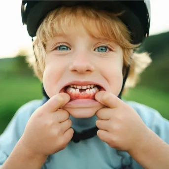 Young boy showing his missing teeth